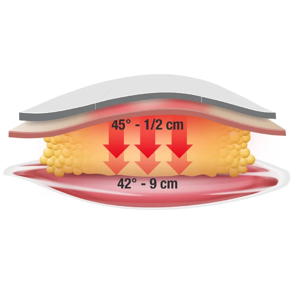 Dettaglio Infrarossi tramite fasce Slimband — Infrared