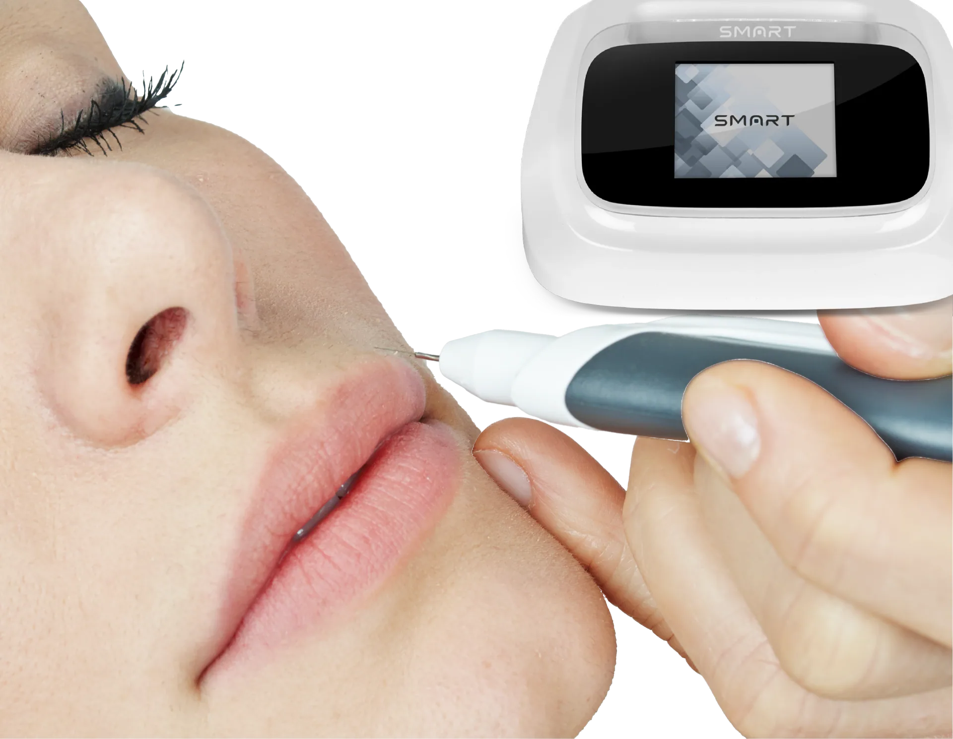 Epilation SMART con apparecchiatura e manipolo Ago Flash
